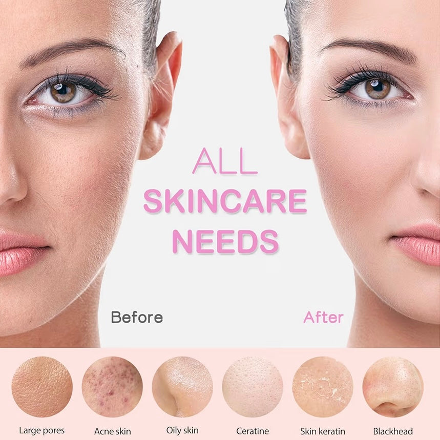 Rechargeable Silicone Face Scrubber with Heat Massage End