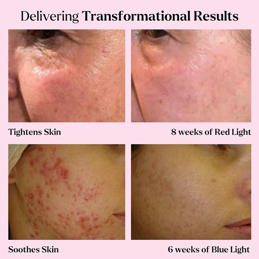 LED Face Mask Light Therapy Premium Spa Kit