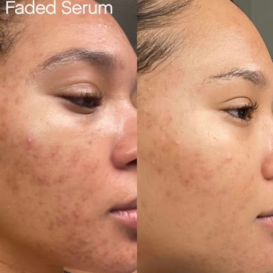 Topicals Faded Brightening and Clearing Serum