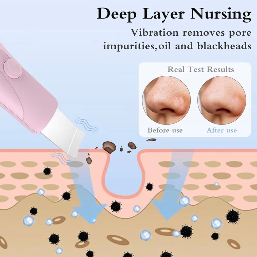 Skin Scrubber for Deep Cleansing & Blackhead Removal